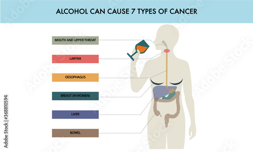 Alcohol causes cancer