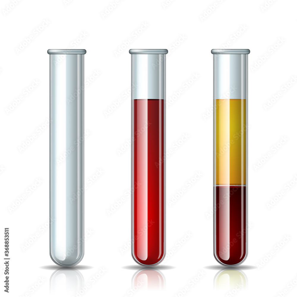 Set of glassware tube empty, filled blood and Fractioned blood in vitro, plasma and layers red blood cells. Set of glassware tube empty, filled blood and Fractioned blood in vitro, plasma and layers red blood cells.