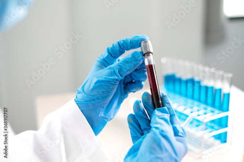 Photos Professional doctors perform find virus tests from samples of blood tests to dia