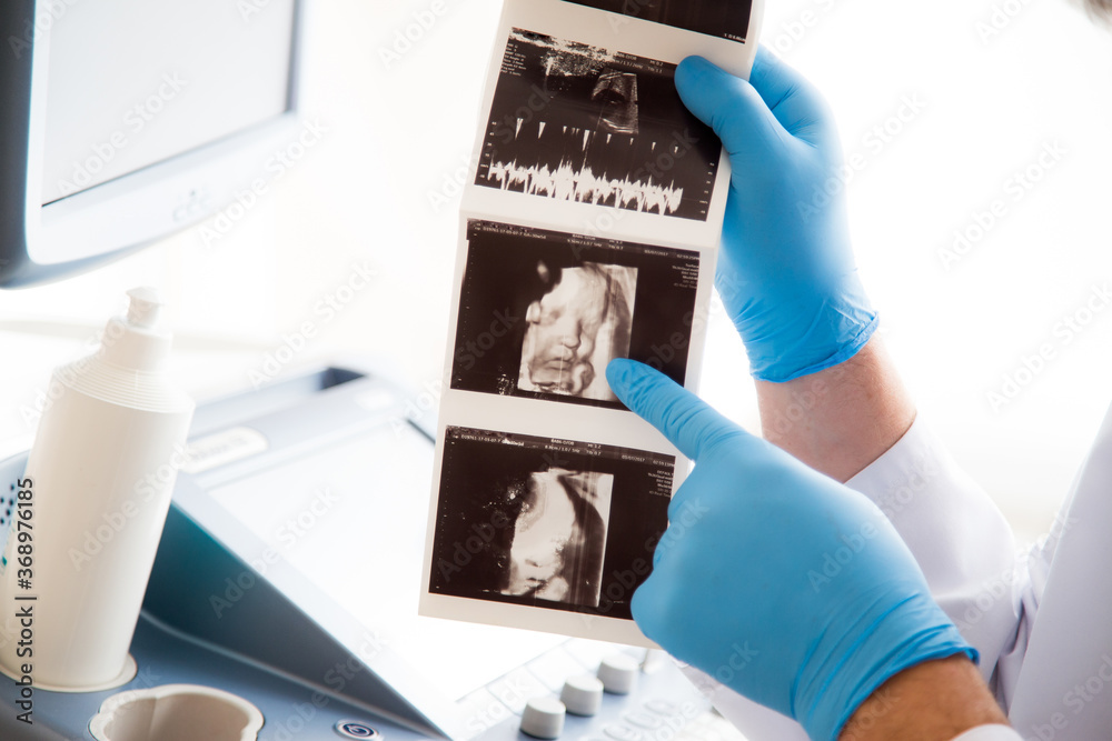Lekarz ginekolog trzyma w ręku zdjęcie usg. Klinika ginekologiczna.  - obrazy, fototapety, plakaty 