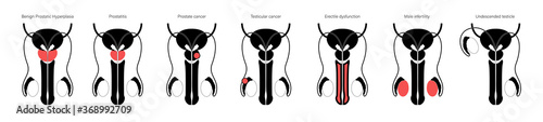 Reproductive system concept