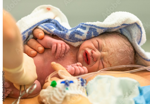 Принти на полотні New born baby being treated just after the birth.