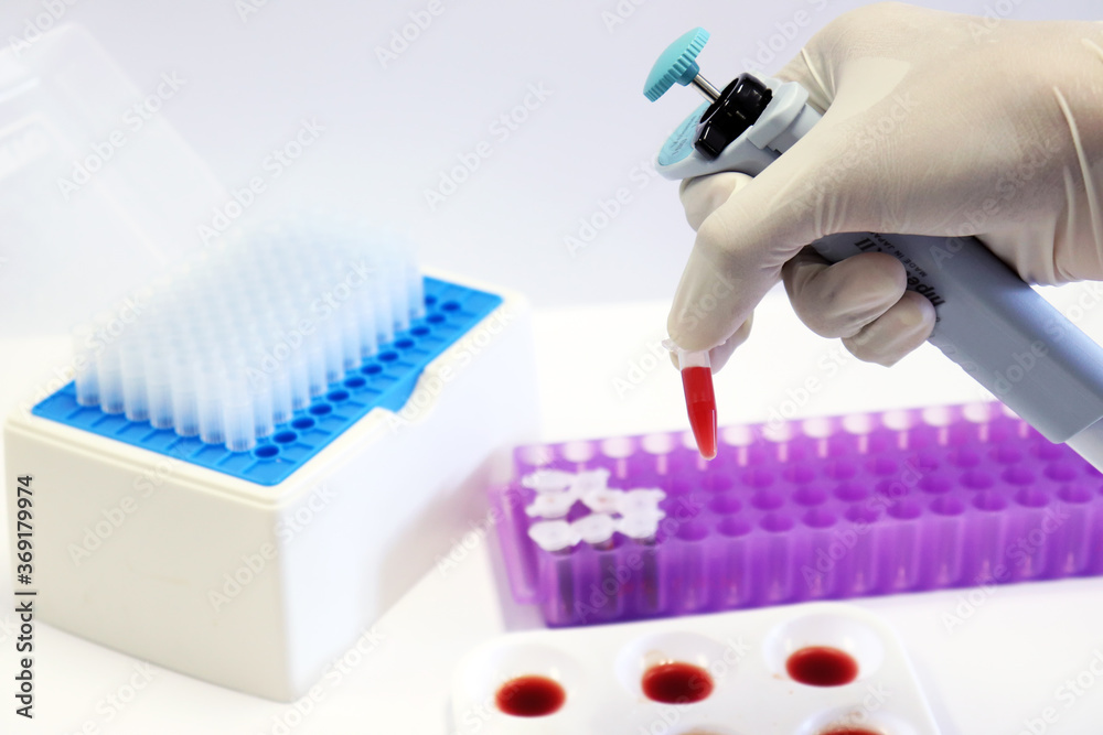 Scientist transfers blood sample into micro centrifuge tubes by using micropipette handle in
