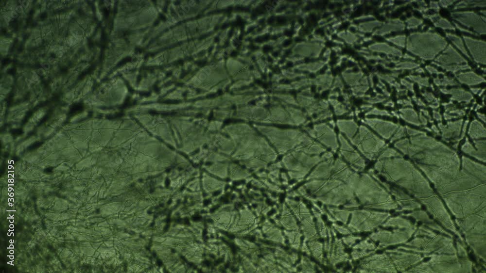 Watch mould grow at a fascinating pace in this microscopy timelapse (fast)