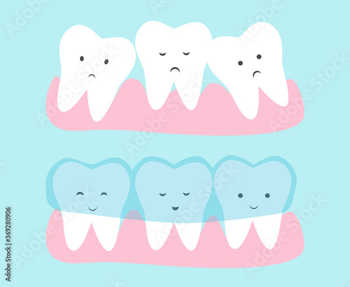 Cute tooth cartoon vector. Invisible dental aligner  concept illustration. Transparent braces for crooked teeth.