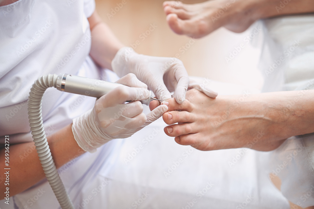 Hardware medical pedicure with nail file drill apparatus. Patient on  pedicure treatment with pediatrician chiropodist. Foot peeling treatment at  spa with a special device. Clinic of Podiatry Podology Stock Photo | Adobe
