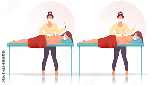Young Woman Receiving Acupuncture and Cupping Treatment on Back in Therapy During Coronavirus Pandemic.