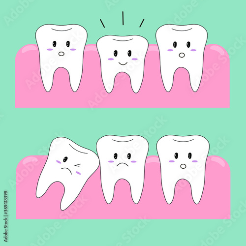 Vector illustration. The choice of images. Funny teeth. Teeth icons. Problems with the teeth. Abnormal development of the tooth. Caries. Correction of teeth.
