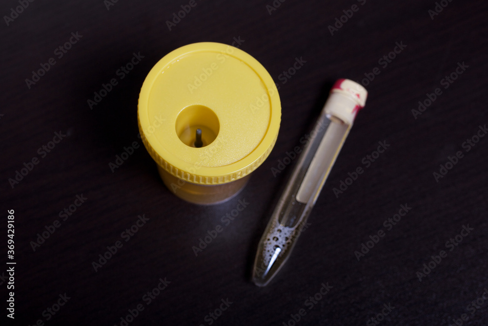 Urine in test container and vacuum tube. Disposable medical polymeric