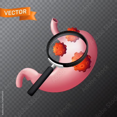 Human stomach under a magnifying glass with viral cells. Vector medical illustration of finding virus or search in the internal organ with a magnifier isolated on a transparent background