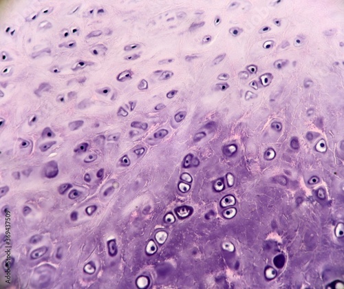 A section of elastic cartilage from an accessory tragus. Microscopic view. photo