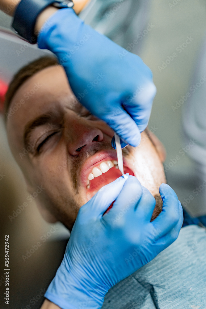 Dental file strip for teeth cleaning, dental hygiene. Dentist at work