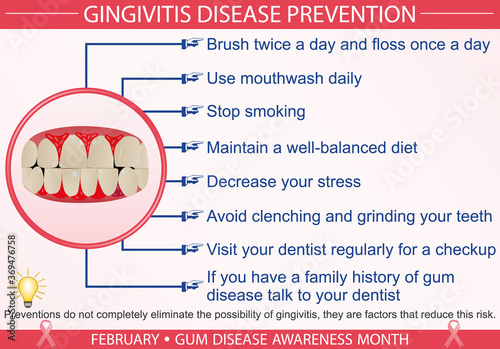 Gingivitis disease prevention infographic vector. February gum disease awareness month concept. Well-organized Eps 10 file.