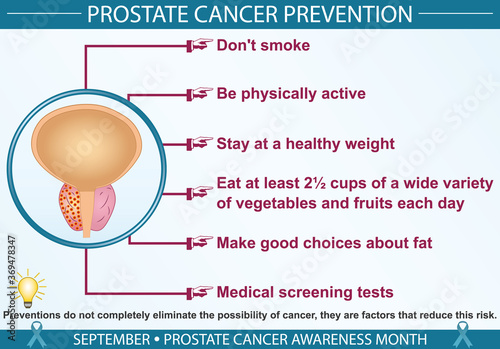 Prostate cancer prevention infographic vector. September prostate cancer awareness month concept. Well-organized Eps 10 file.