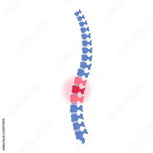 Flat vector illustration of problem with human spine silhouette. Concept of pain in vertebral column. Backbone icon for orthopedic  osteopathy  surgery