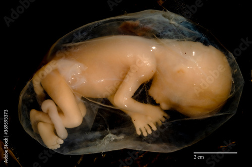 Fototapeta 13,5 week old human fetus inside de amniotic sac (without the rest of the placenta)