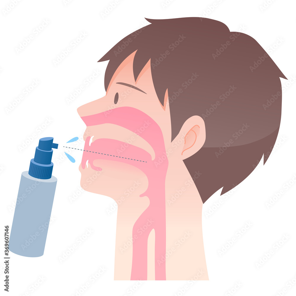 喉スプレーを使用したケアイラスト カラー男性 Medical Illustration Stock Vector Adobe Stock