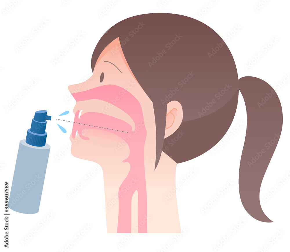 喉スプレーを使用したケアイラスト カラー女性 Medical Illustration Stock Vector Adobe Stock