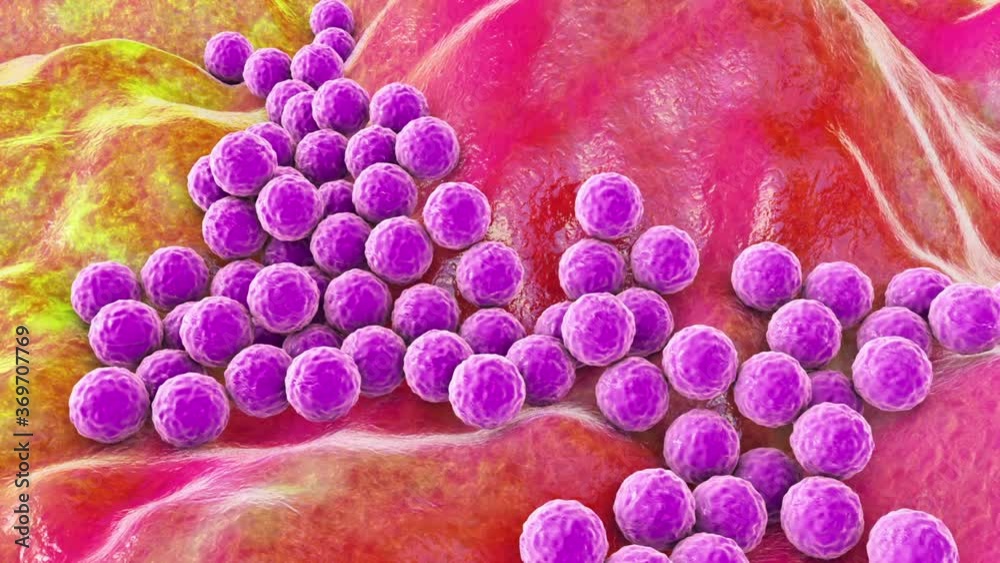 Bacteria Staphylococcus aureus, Staphylococcus epidermidis, MRSA, multidrug resistant bacteria, 3D animation