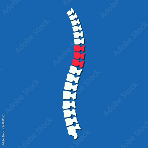 Flat vector illustration of problem with human spine silhouette. Concept of pain in vertebral column. Backbone icon for orthopedic  osteopathy  surgery