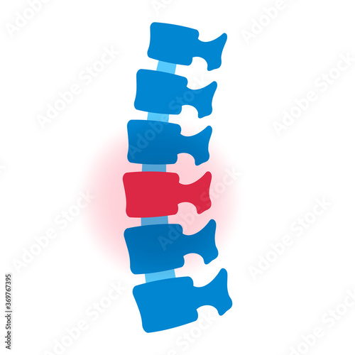 Flat vector illustration of problem with human spine silhouette. Concept of pain in vertebral column. Backbone icon for orthopedic, osteopathy, surgery