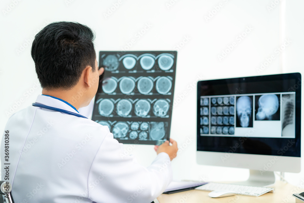 Asian man doctor holding and looking to examining x-ray of the patient’s skull and brain in a medical clinic at hospital.