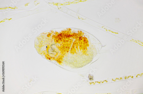 Принти на полотні Microscopic view of planktonic wheel animal (rotifer)
