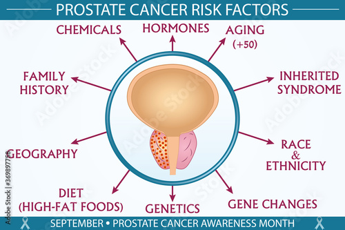 Prostate cancer risk factors infographic vector. September prostate cancer awareness month concept. Well-organized Eps 10 file. photo