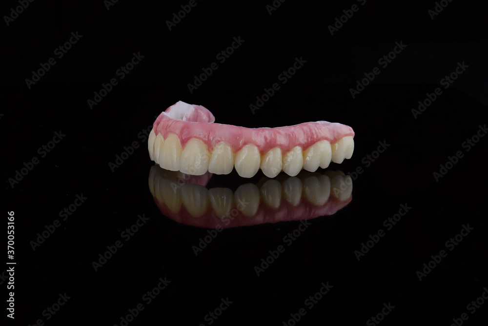 Obraz premium High-quality dental prosthesis made by dental technician, prosthesis with a pink gingiva to fix after implantation.
