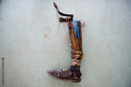 A homemade prosthetic leg made from a water pipe and twigs