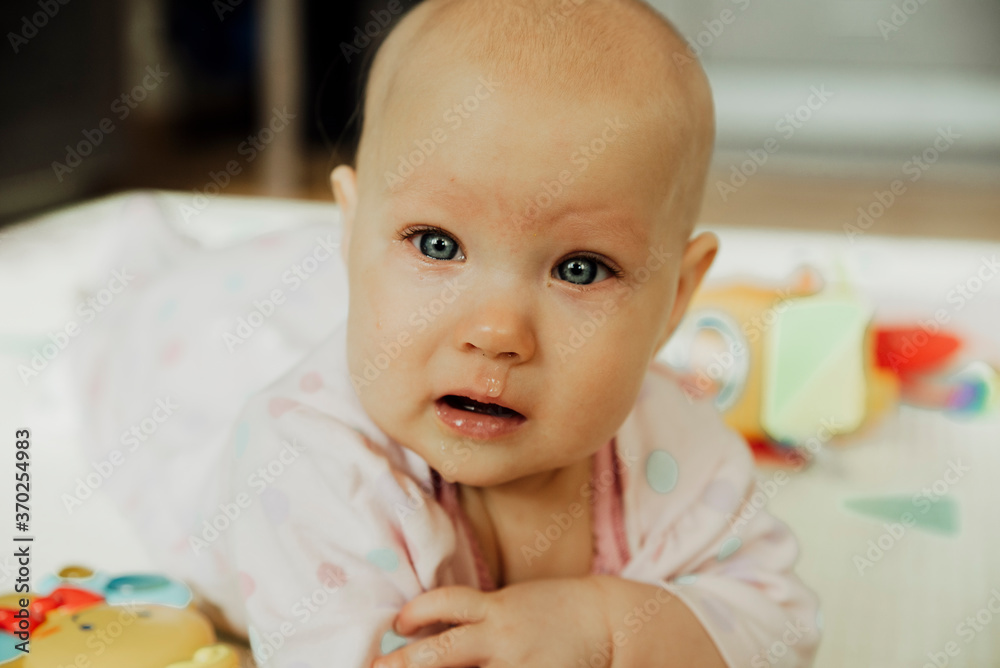 the first cold in a young child, crying, glass eyes, illness the first cold in a young child, crying, glass eyes, illness