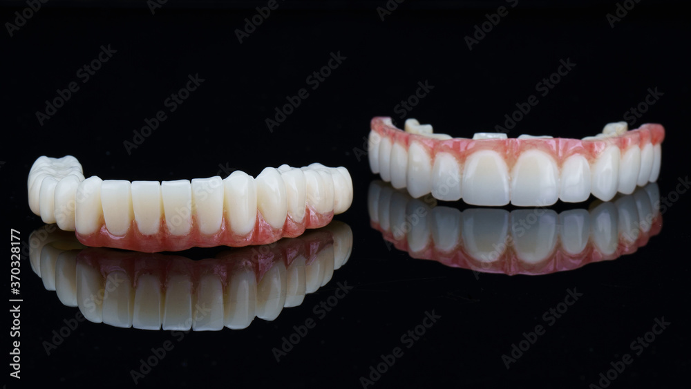 temporary dental prostheses for the upper and lower jaw with artificial gums on a black background temporary dental prostheses for the upper and lower jaw with artificial gums on a black background