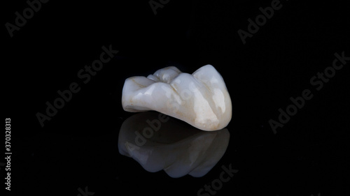 Slika na platnu dental inlay made of ceramic with morphology on the chewing tooth, filmed on bla