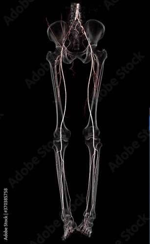 CT SCAN 3D of vascular of both with transparent bone. CTA Peripheral run-off
