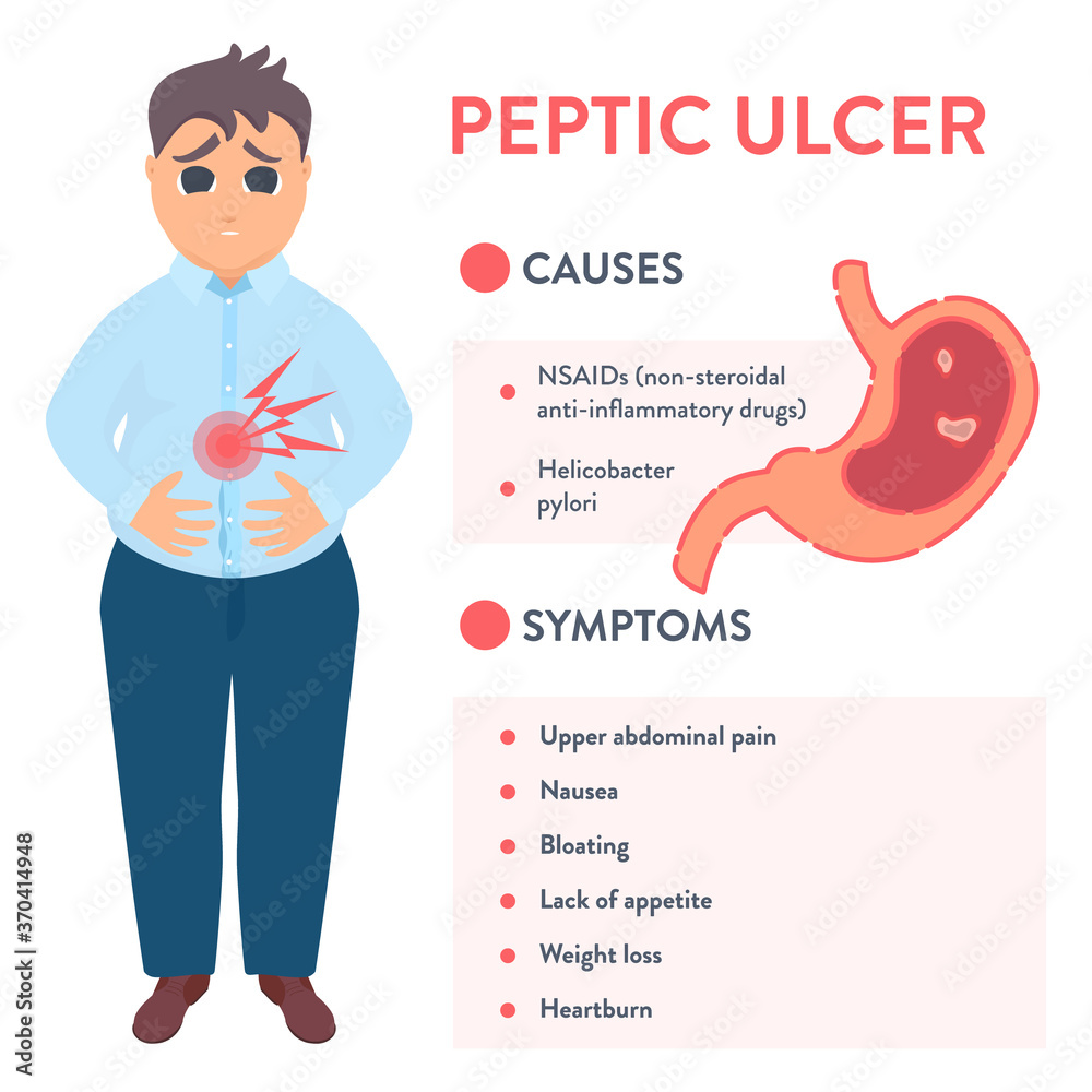Types Of Peptic Ulcer Stomach Disease Infographics Cartoon Vector | The ...