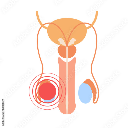 Reproductive system concept