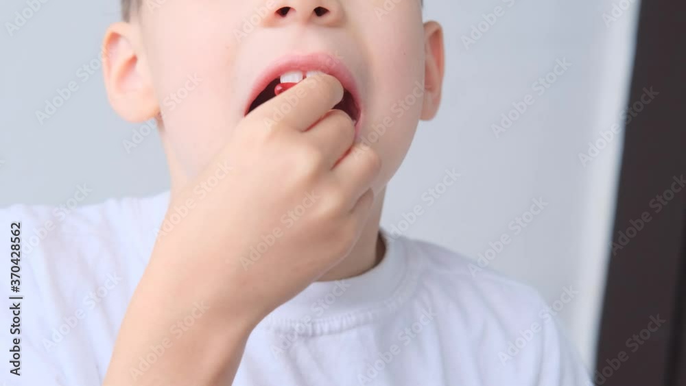 boy, kid holds in his mouth and eats gelatinous sweets, gummy bear