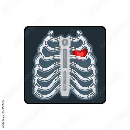 X-ray vector illustration. X-ray of a human breast with a red heart.