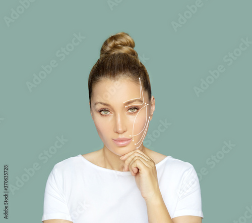 Fotografie thread lift procedure  ,non-surgical facelift,markup
