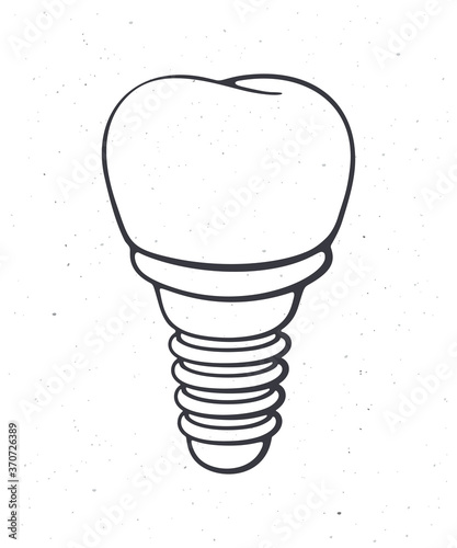 Dental implant of human tooth. Outline. Vector illustration. Symbol of somatology and oral hygiene. Fixture prothesis in dentistry. Hand drawn sketch. Isolated white background