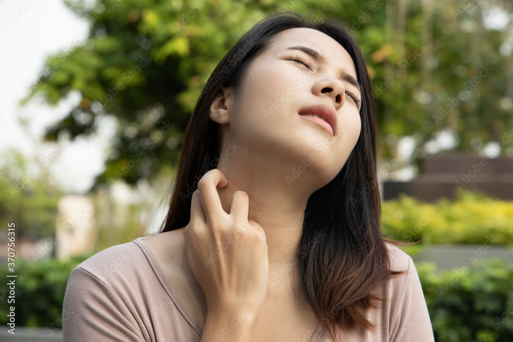 Asian woman scratching her neck skin; concept of dry skin, allergic skin inflammation, body care, fungus inflammation, dermatology disease, eczema, rash, skin care; young adult asian woman model
