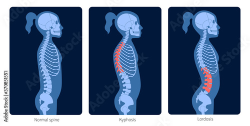 Картината върху платно Spine X ray