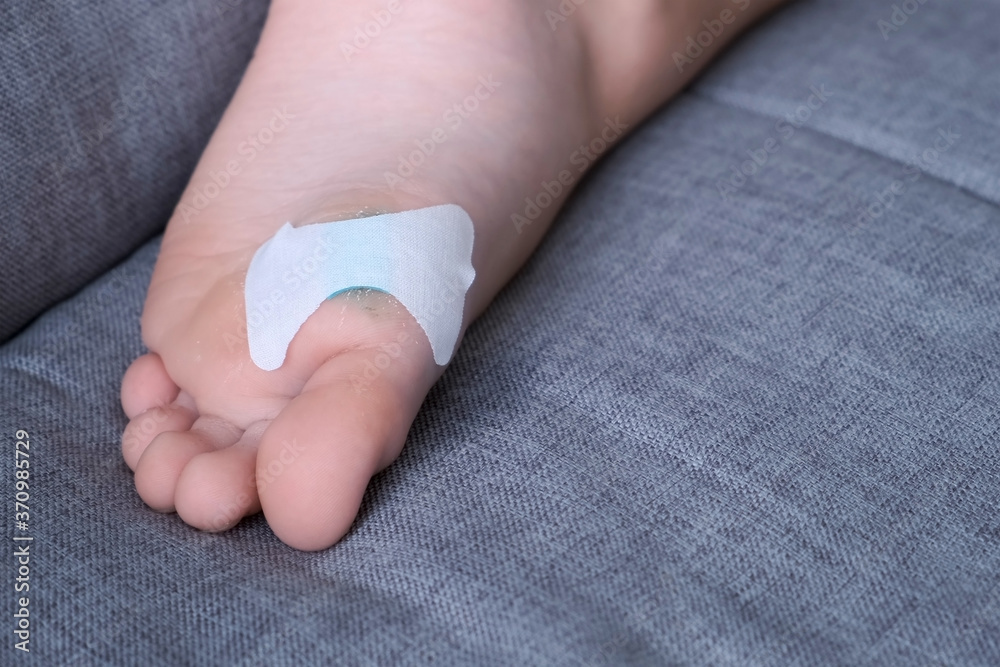 Wound sticked plaster on child's foot, closeup view. Treatment and care after laser removal of
