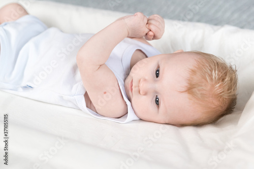 A beautiful newborn in a white bodysuit with traces of BCG vaccination-the TB vaccine-on his arm. The baby is lying on changing table and looks away