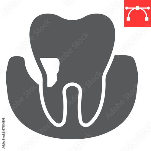 Periodontitis glyph icon, dental and stomatolgy, periodontal tooth sign vector graphics, editable stroke solid icon, eps 10.