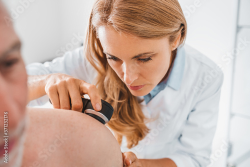 Doctor dermatologist examines skin of patient. Dermatoscopy, prevention of melanoma, skin cancer. photo