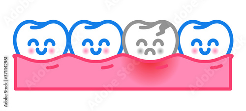 Vector cute healthy cartoon tooth and tooth decay isolated on white. Toothache and gingival inflammation