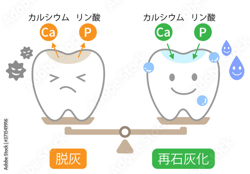 歯　脱灰と再石灰化
