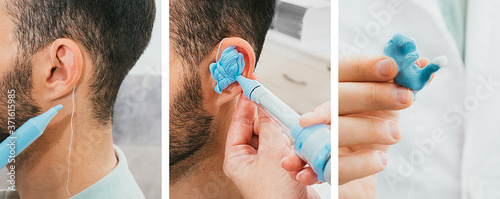 Set of making a custom earplug for a man. Stages of manufacturing earplugs. Doctor makes custom molded ear plugs for the patient. Ear close-up photo