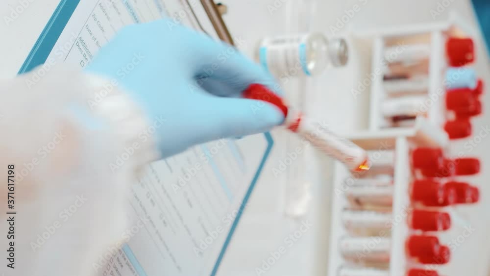 Postive Labratory Test Vertical footage of laboratory technician holds in one hand laboratory ...